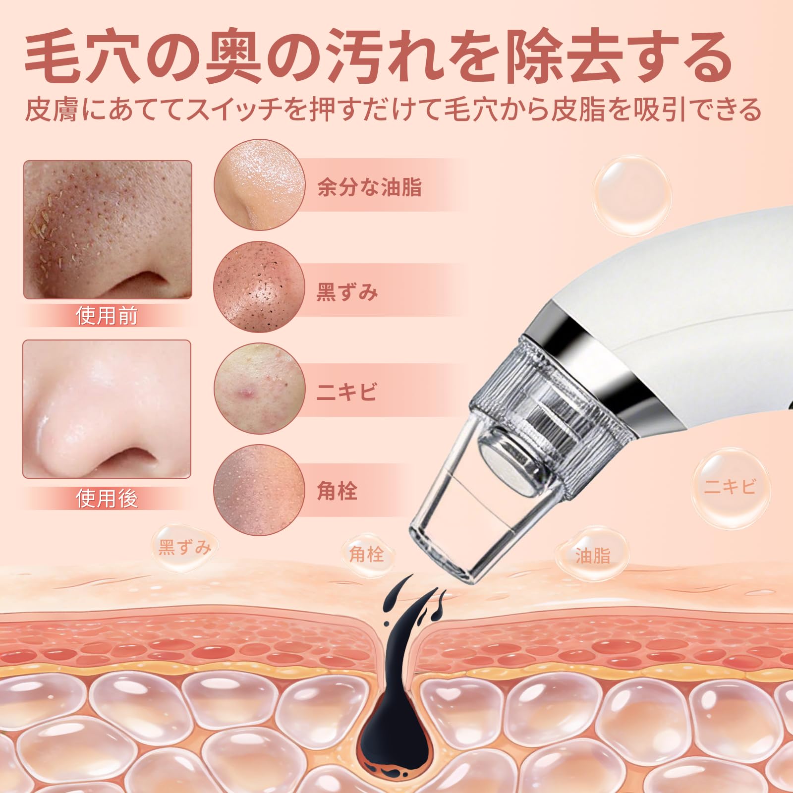 Amazon.co.jp: Yoosyan 毛穴吸引器 敏感肌対応 5段階吸引力 5種類交換